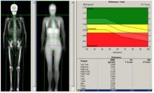 Sports Physiology: Optimizing the Human Machine!